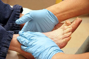 diabetic foot treatment in the Houston, TX 77095 area