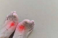 Footwear and Its Impact on Gout Patients