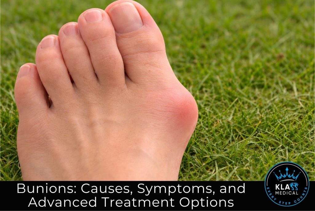 Bunions Causes, Symptoms, and Advanced Treatment Options