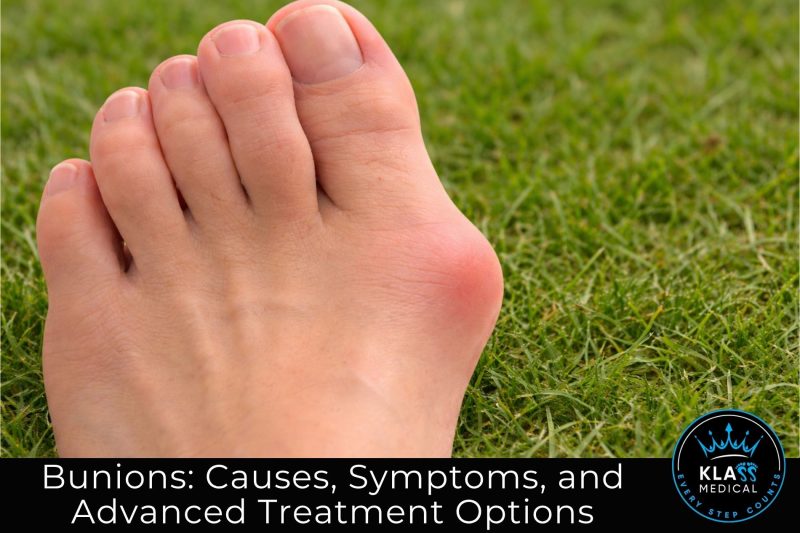 Bunions Causes, Symptoms, and Advanced Treatment Options