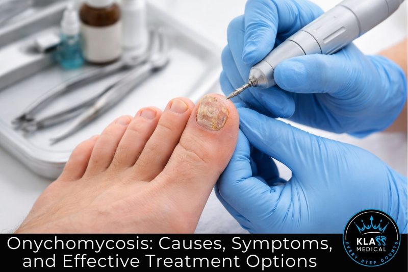 onychomycosis, fungal nail infection, toenail fungus treatment, podiatrist Cypress TX, nail fungus symptoms, laser nail fungus treatment, foot care, podiatry services, diabetic foot care, Klass Medical LLC